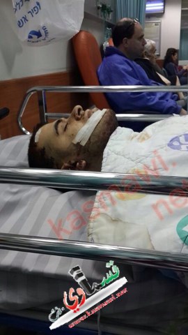عاجل : اصابة حرجة لشاب قسماوي بعد تعرضة لاعتداء من قبل متطرفين يهود 